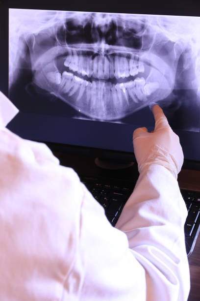 Best Emergency Dentist for Lost Fillings or Crowns in Orchard Mesa, CO